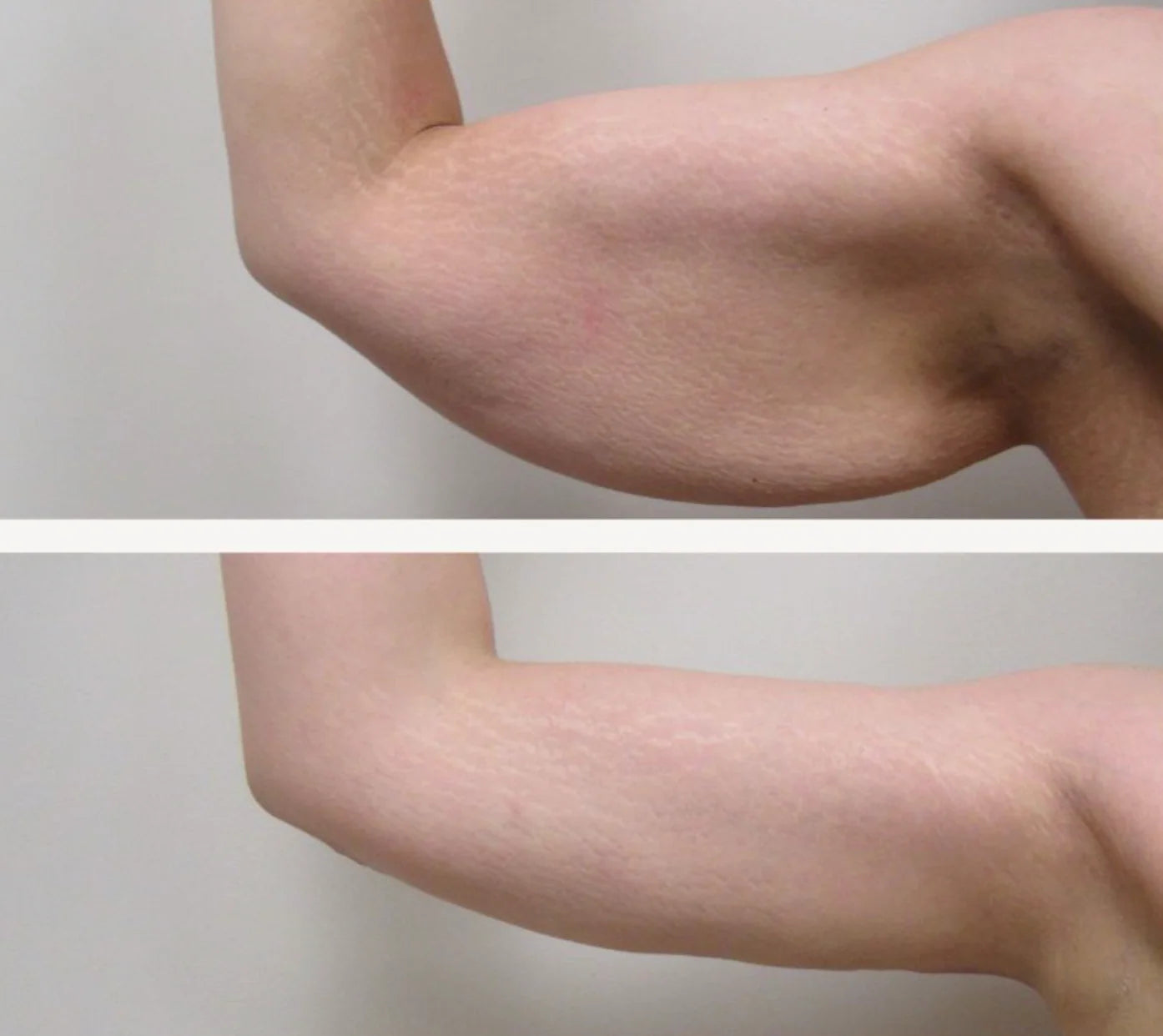 Before and after with the FLAT OUT formula