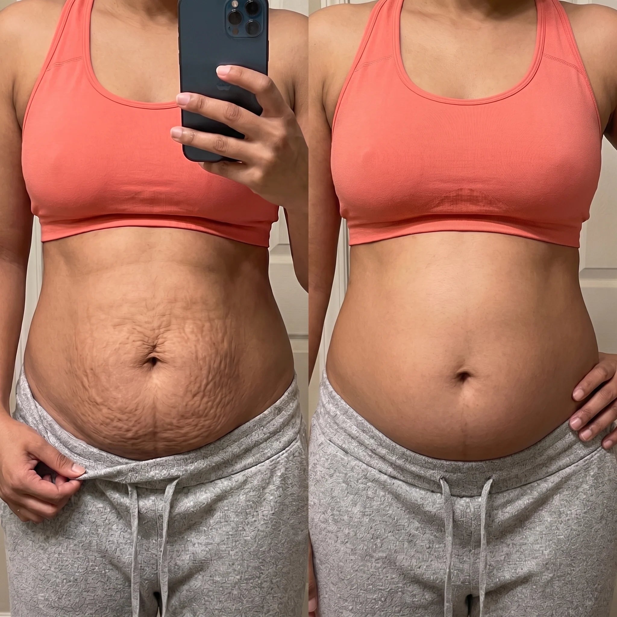 Before and after with the FLAT OUT formula